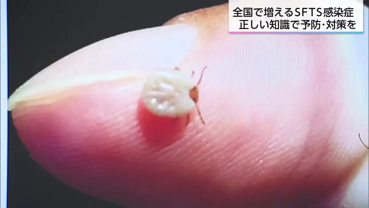 日テレNEWS NNN 6月30日(火) 18:40 マダニが媒介する感染症SFTS 過去