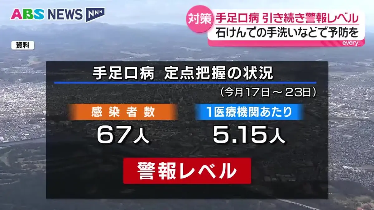 日テレNEWS NNN 8月27日(木) 18:54 子どもが感染しやすい「手足口病
